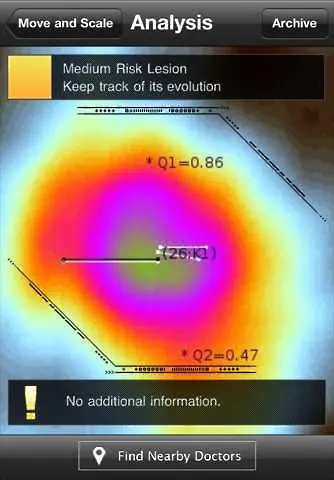 Ново приложение за iPhone ще следи за опасни лунички