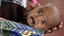 29 000 деца загинаха от глад в Сомалия