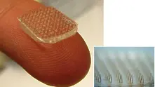 Полимерен пластир, вдъхновен от природата, лекува по-ефективно рани