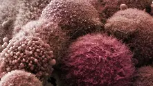 Учени създадоха нов тест за диагностика на рак на панкреаса в ранен стадий