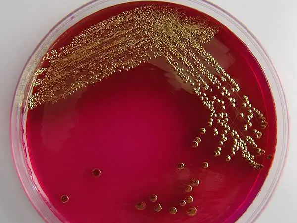 На крачка от научен пробив в борбата с опасните бактерии