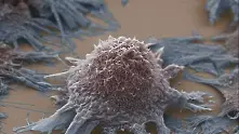 Лекари откриха ахилесовата пета на раковите клетки