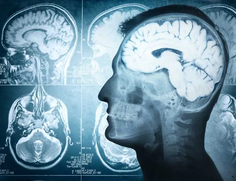 Учени: Мозъкът работи и след смъртта