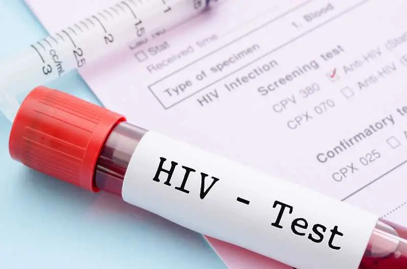 Учени са на крачка от откриването на лечение от ХИВ