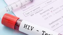Учени са на крачка от откриването на лечение от ХИВ