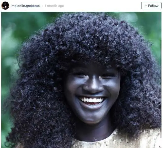 Момичето, което покори интернет с цвета на кожата си