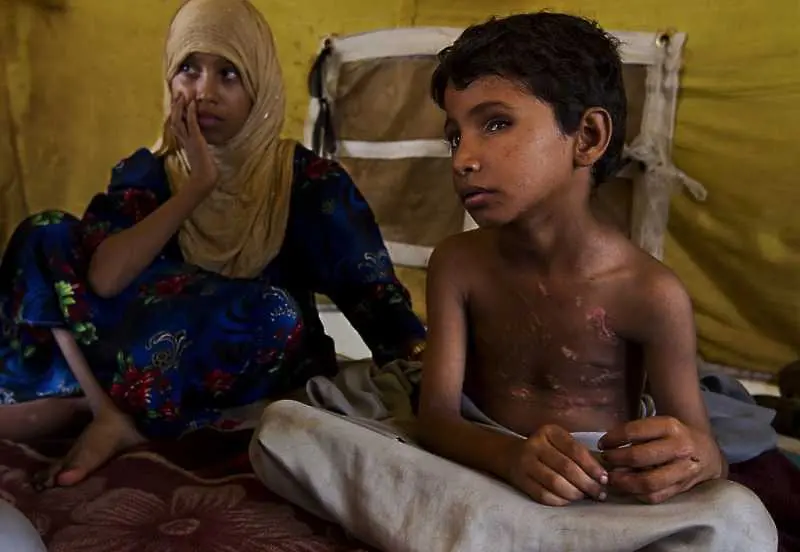 Близо 250 000 са болните от холера в Йемен, 1500 са починали