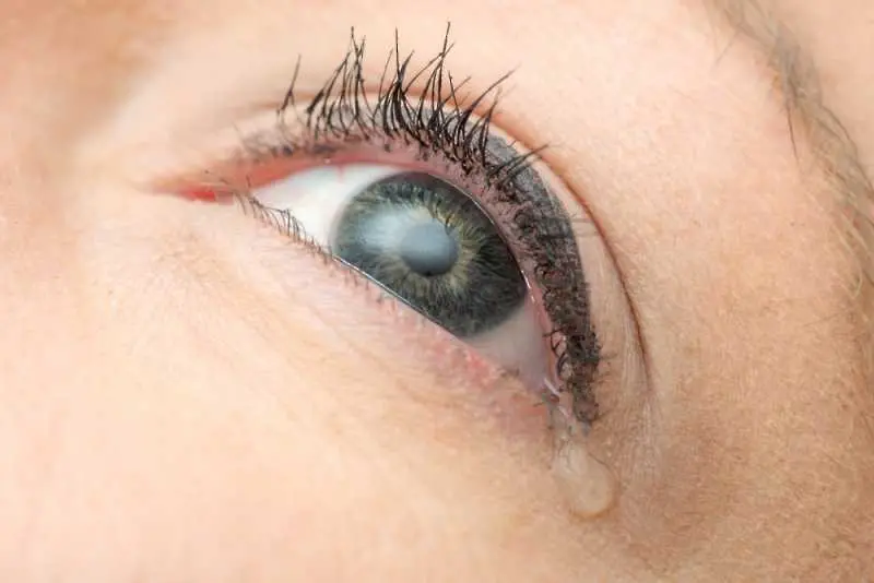 Момиче, около чиито очи се появяват кристали, вместо сълзи, озадачава лекарите