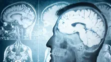 Неврологичните симптоми при Covid-19 и въздействието му върху мозъка