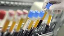PCR-тестът вече ще се плаща от Здравната каса