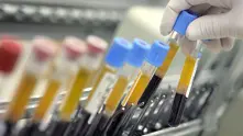 Дъщерната компания на Johnson & Johnson ще произвежда ваксината си в Холандия. Търси си партньор за опаковките