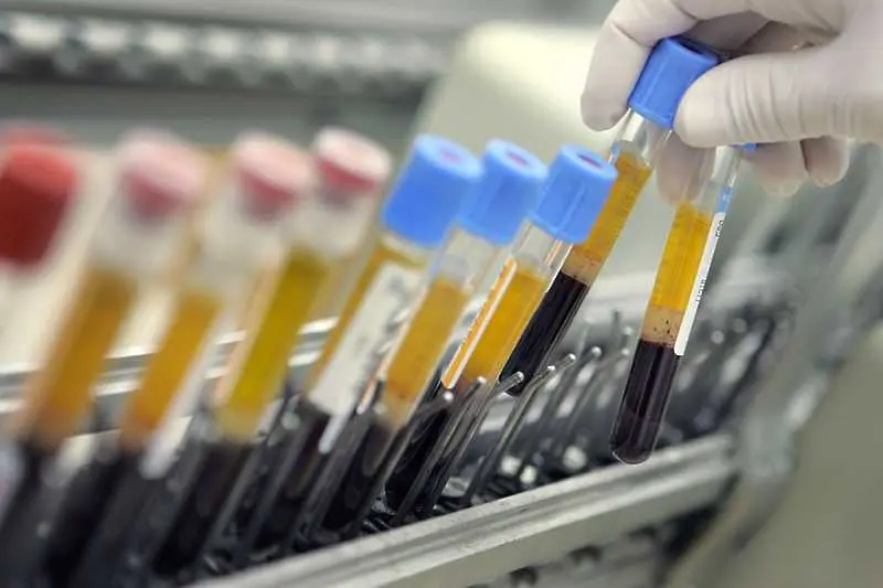 Европол по следите на схеми за търговия с фалшиви отрицателни PCR тестове