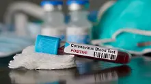 4497 са новите случаи на коронавирус у нас