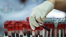 Откриха микропластмаса в човешката кръв в първо по рода си изследване