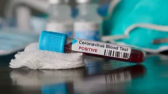 262 са новите случаи на коронавирус у нас