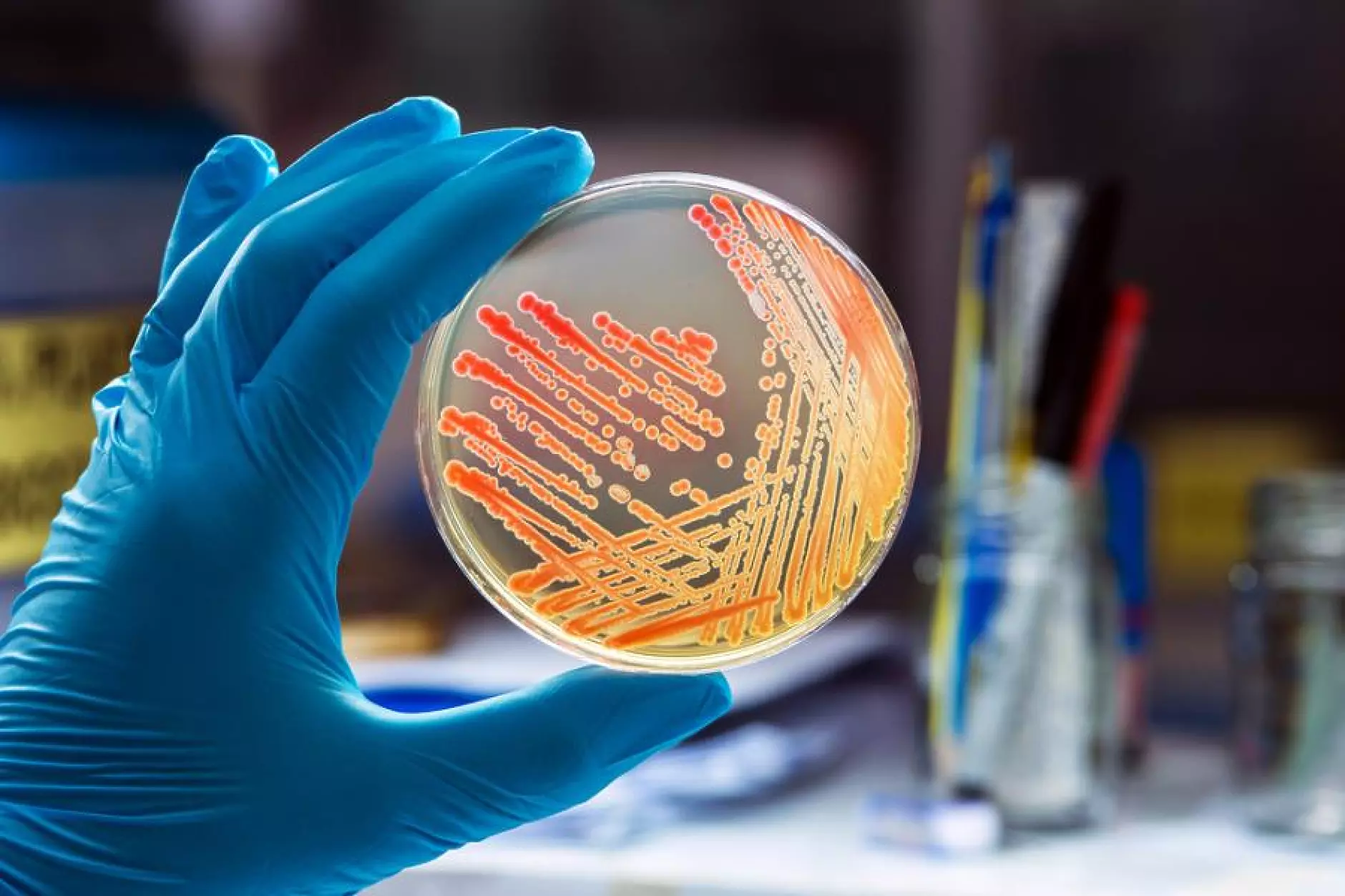 Новооткрита молекула се бори с над 300 вида резистентни на лекарства бактерии