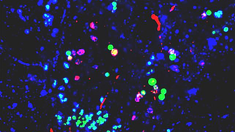 Нанопластмасите са свързани с промени в мозъчните протеини, асоциирани с болестта на Паркинсон