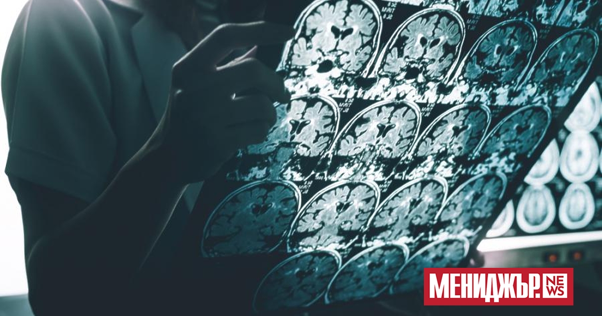 Болестта на Алцхаймер е сложно и трудно за разбиране заболяване,