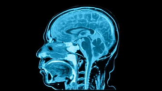 Според ново изследване размерът на човешкия мозък вероятно се увеличава