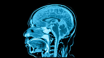 Хормонална терапия би могла да повиши когнитивната функция при хора със синдрома на Даун
