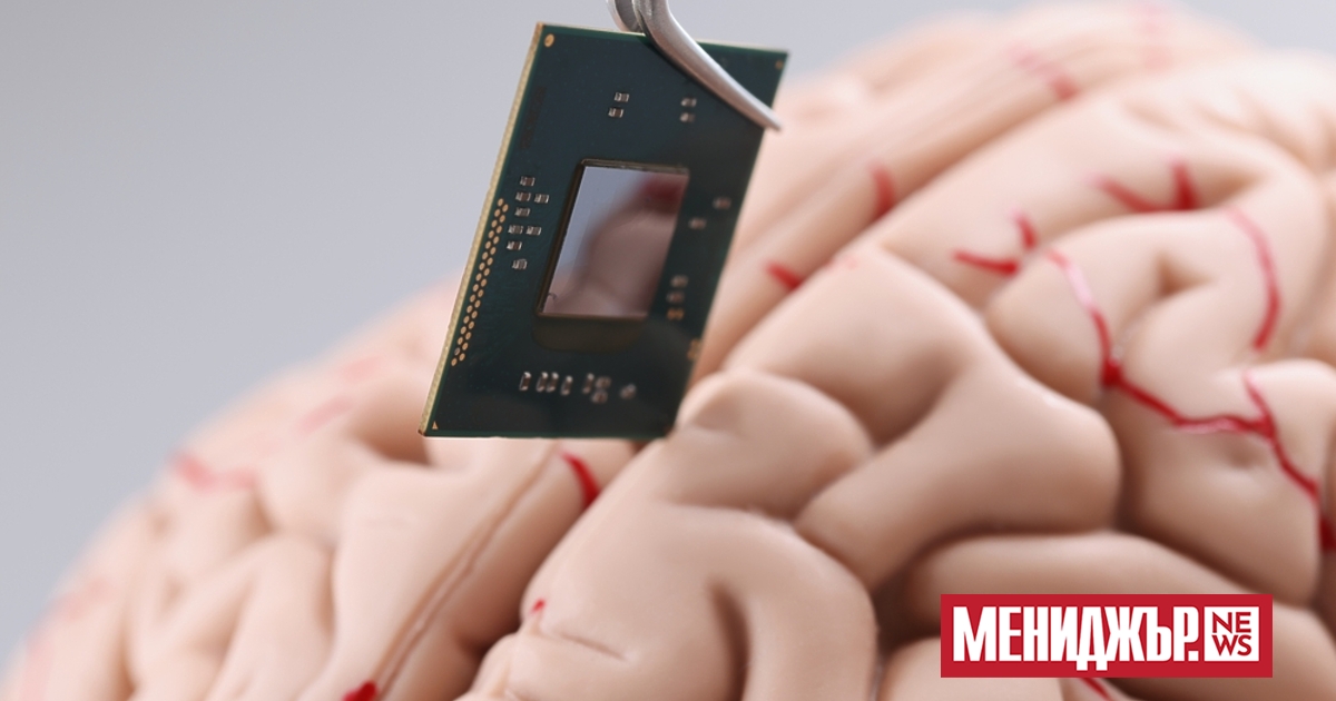 Стартиращата компания Neurotech Paradromics ще изпробва своя мозъчен имплант през