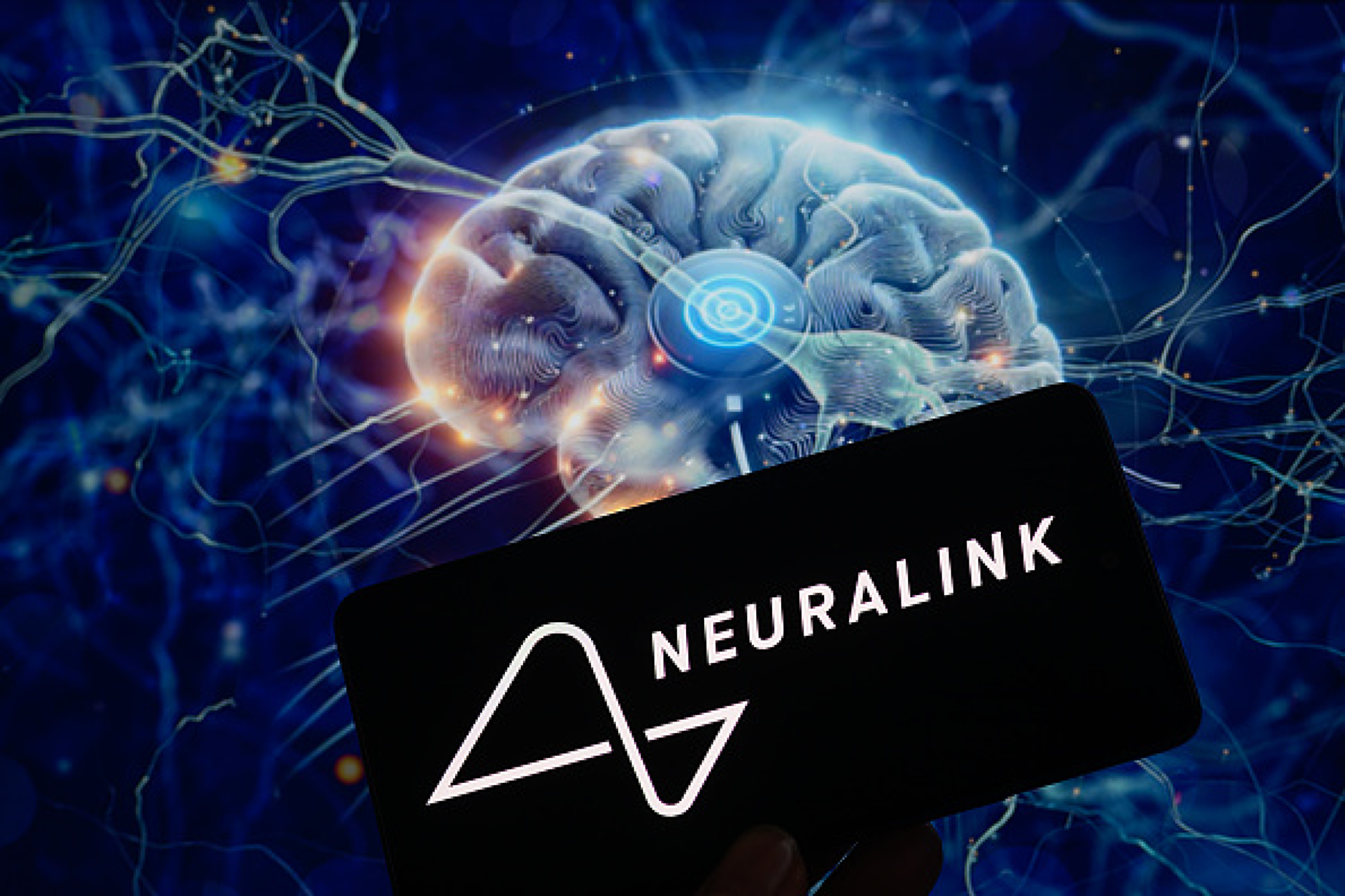 Мъск обеща мозъчни чипове на Neuralink на милиони хора след десет години