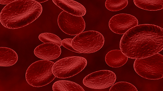 Анемията причинена от недостиг на желязо е широко разпространен здравословен