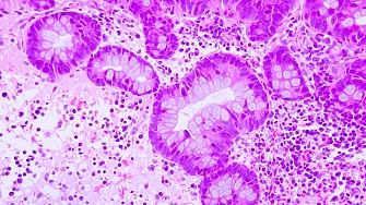 Изследователи съобщават че са разработили нова ваксина на основата на