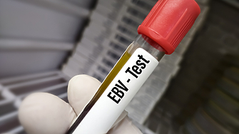 Често срещан вирус който заразява повечето хора може да доведе