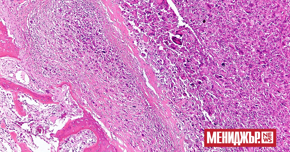 a { text-decoration: none; color: #464feb; } tr th, tr